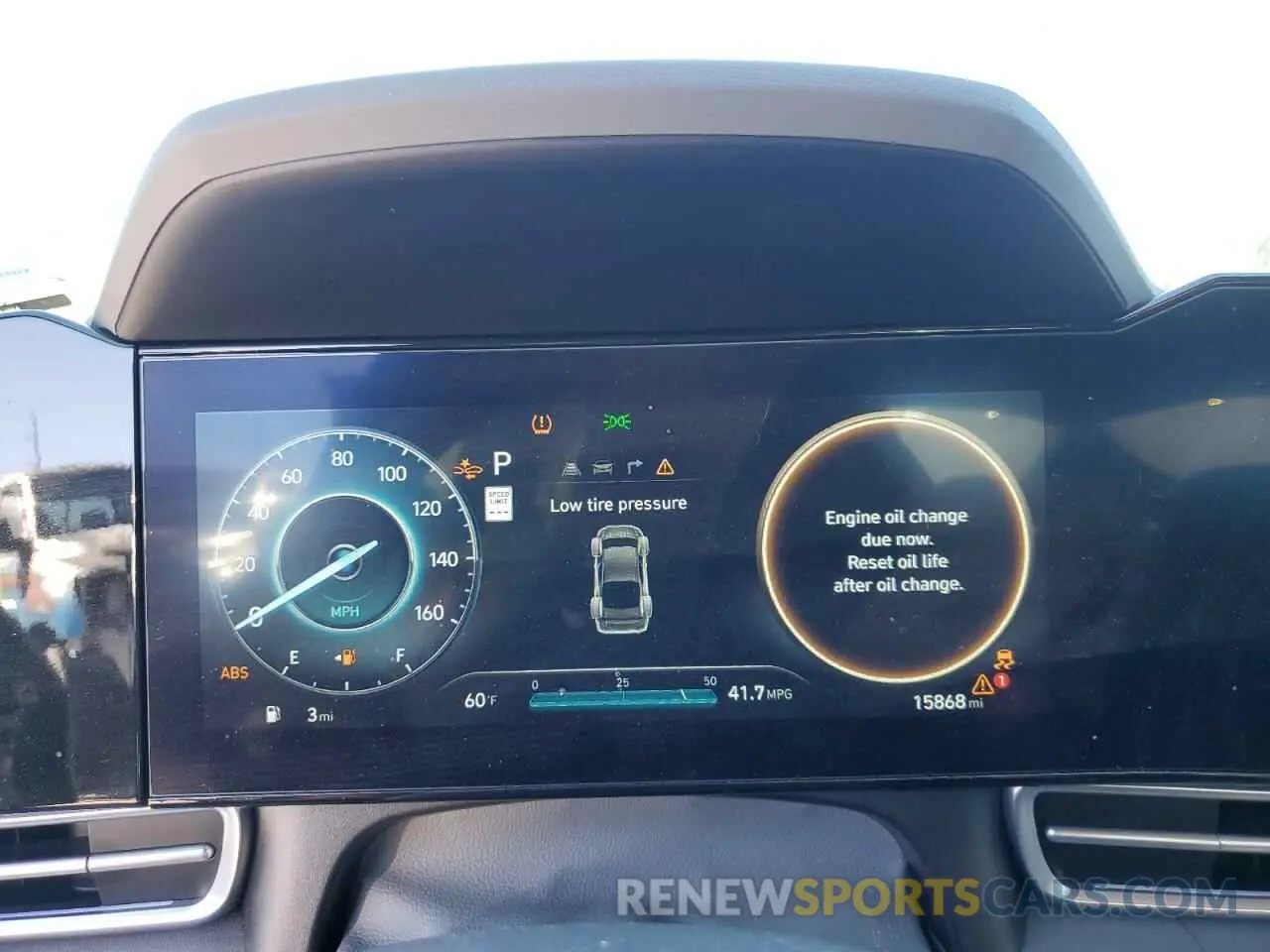 9 fotografías del automóvil dañado KMHLM4DG5RU755176 HYUNDAI ELANTRA 2024