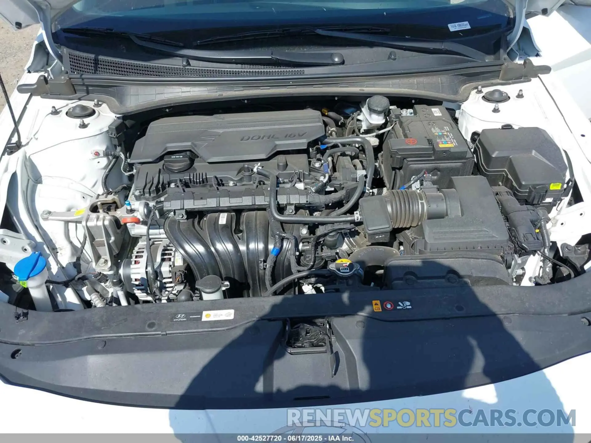 10 fotografías del automóvil dañado KMHLM4DG9RU819624 HYUNDAI ELANTRA 2024