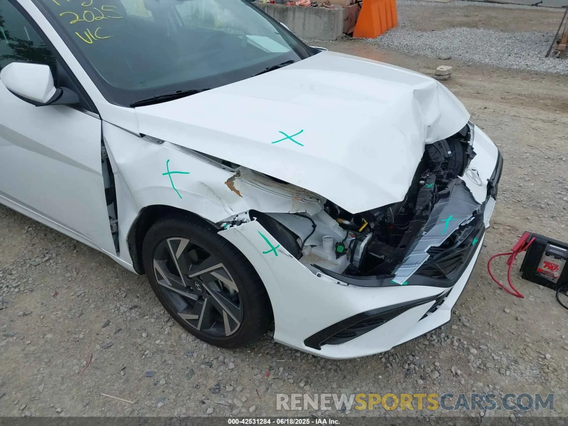 6 fotografías del automóvil dañado KMHLS4DG4SU972231 HYUNDAI ELANTRA 2025